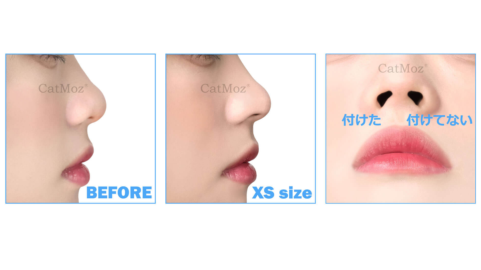 CatMoz3D 鼻プチは、5つのサイズから選べます。