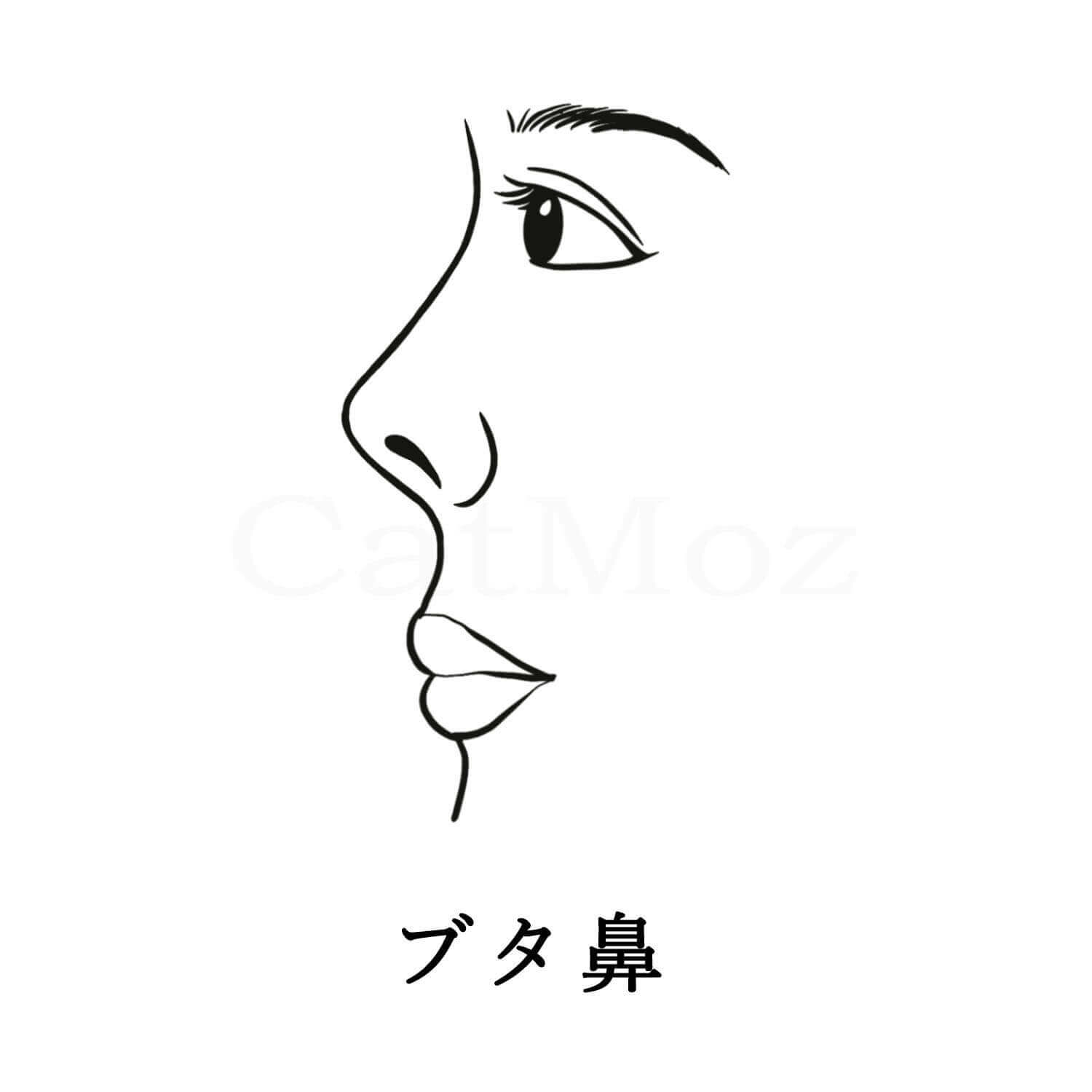 ブタ鼻（上向き鼻）とは鼻先の位置が上だと、正面からも横顔からも見える鼻先が上を向いて、正顔で鼻孔が目たつ。