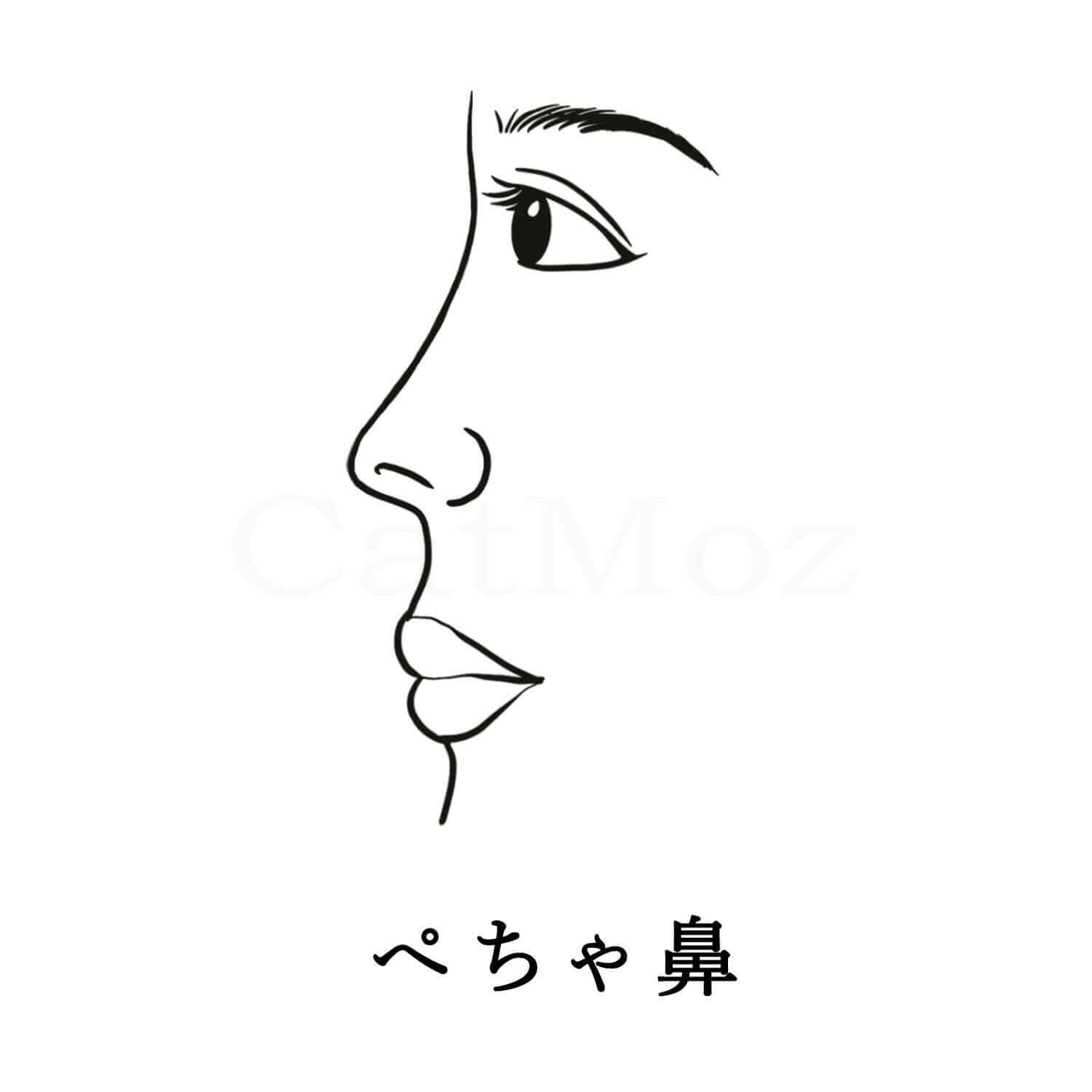 ぺちゃ鼻とは横顔から見えば鼻根が全くない、横顏もほどんどん鼻が見えないタイプです。